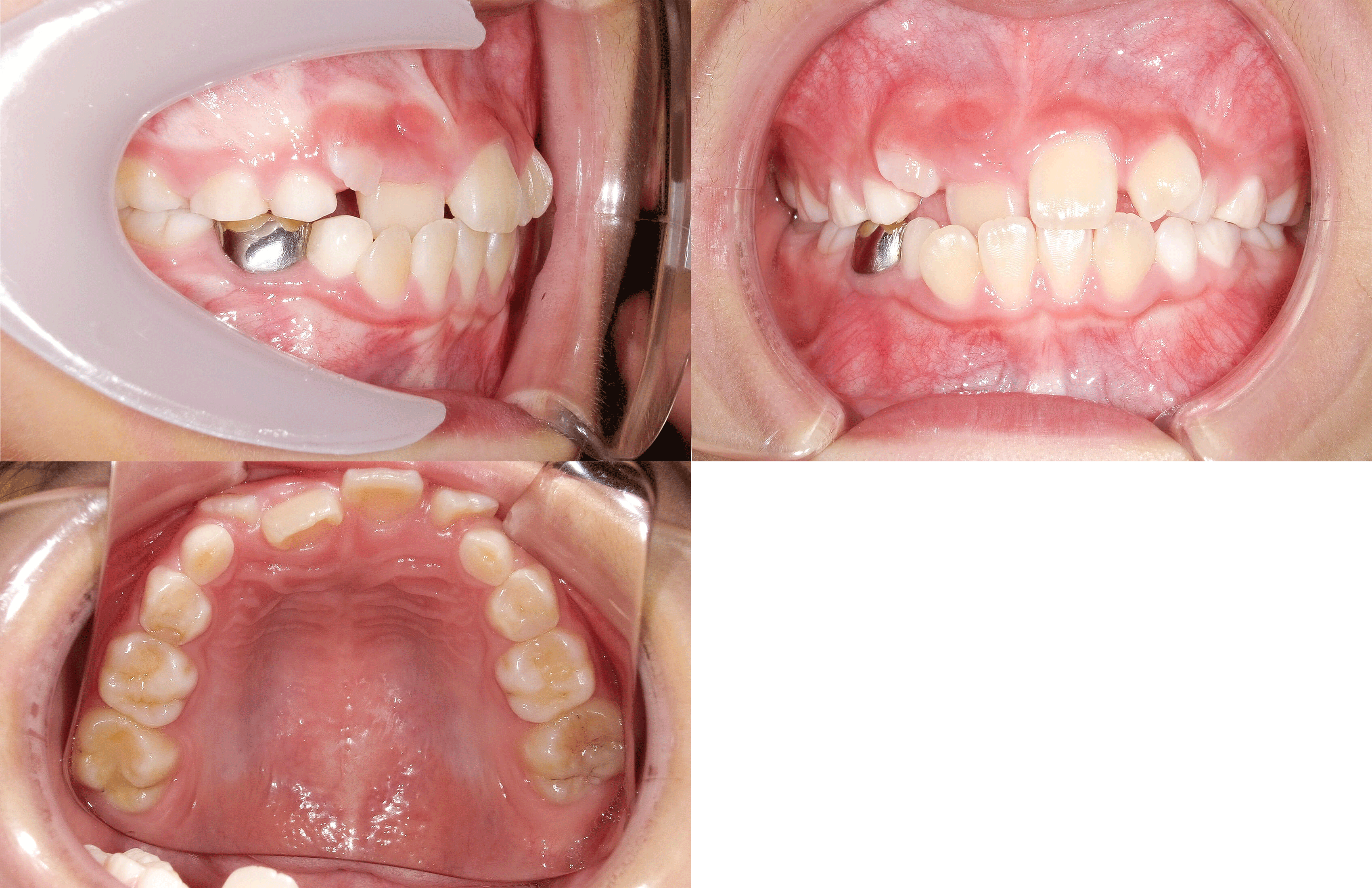 CASE01