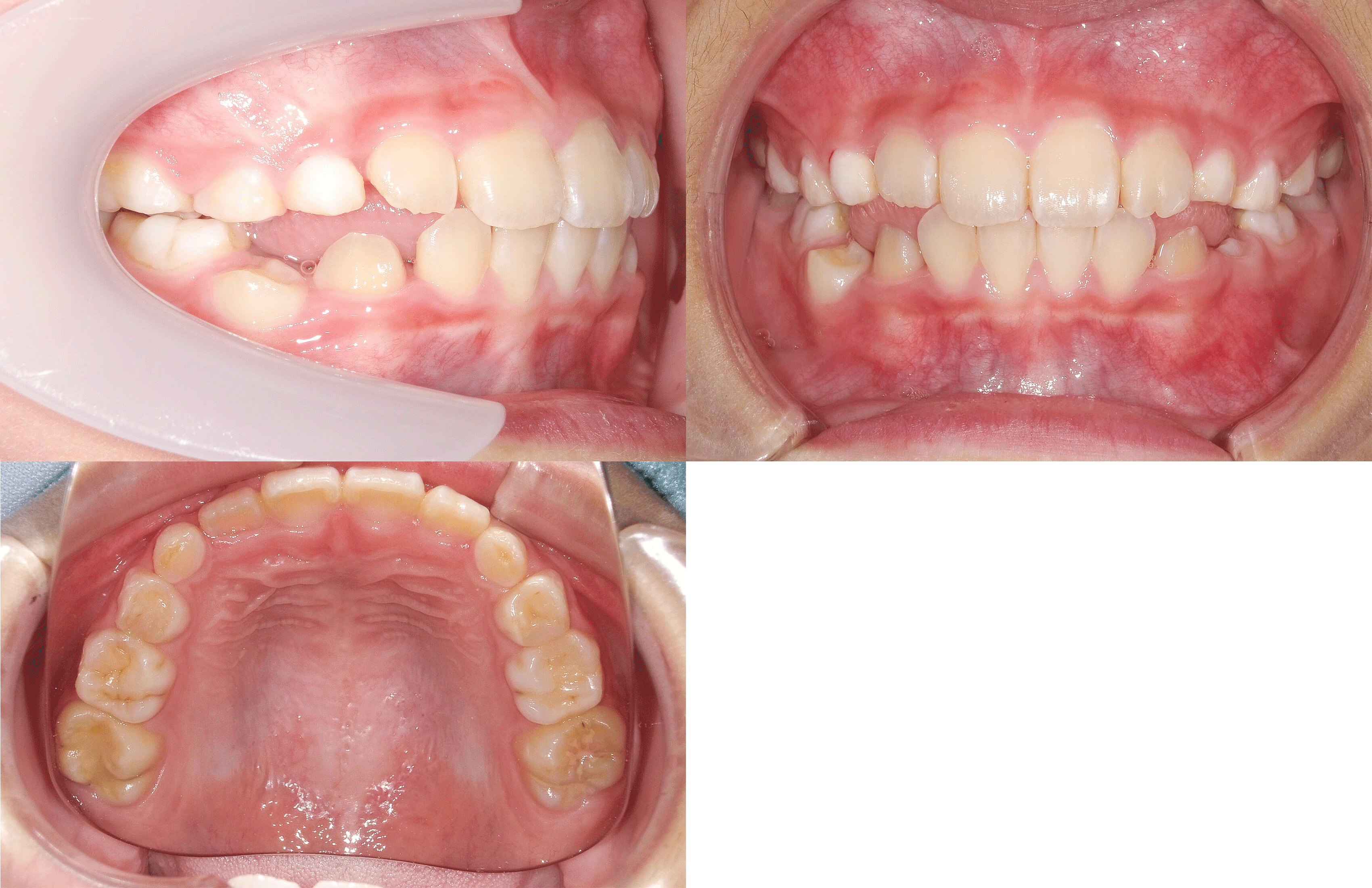 CASE02